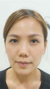 Before